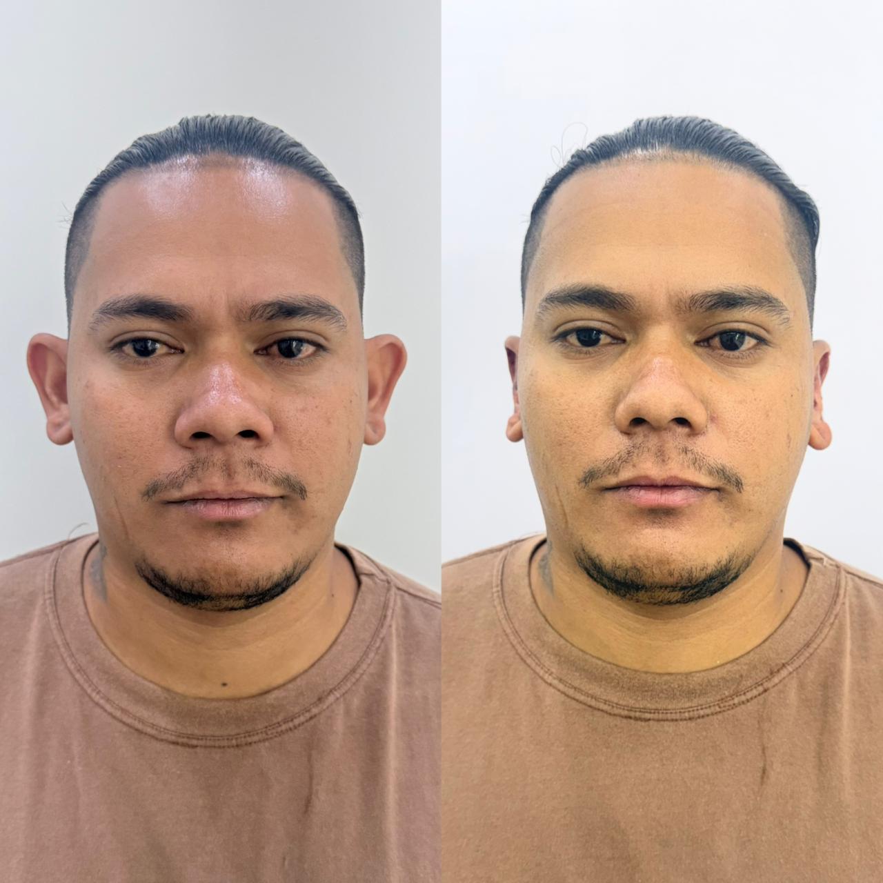 Resultado