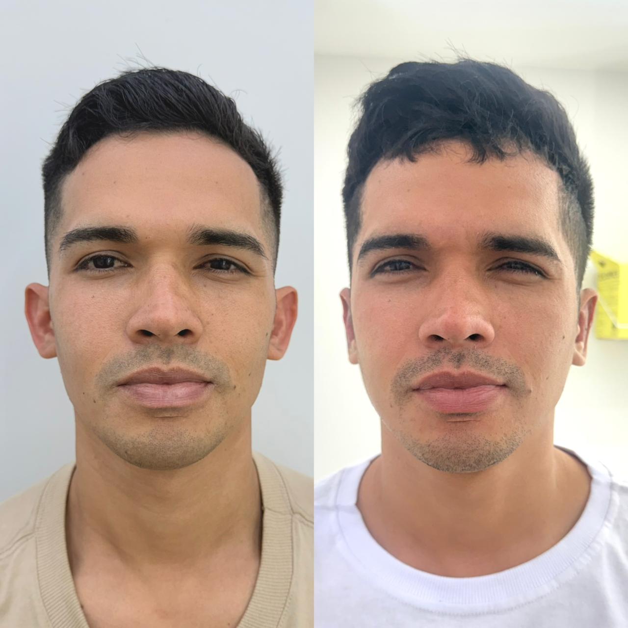 Resultado