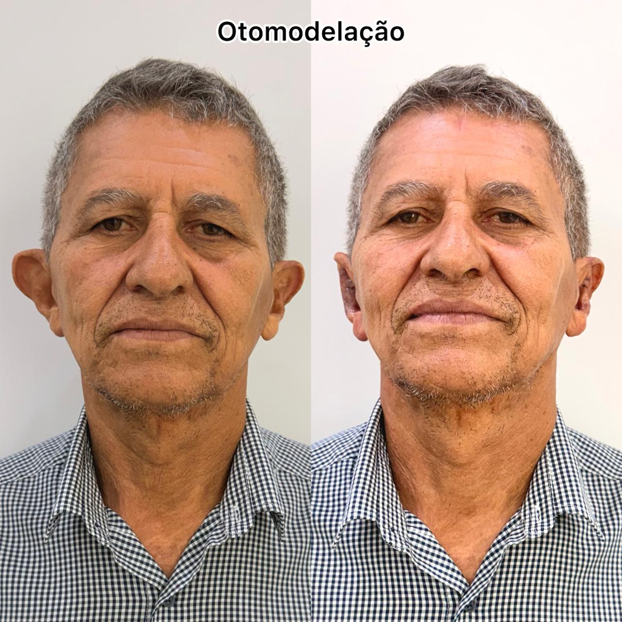 Resultado
