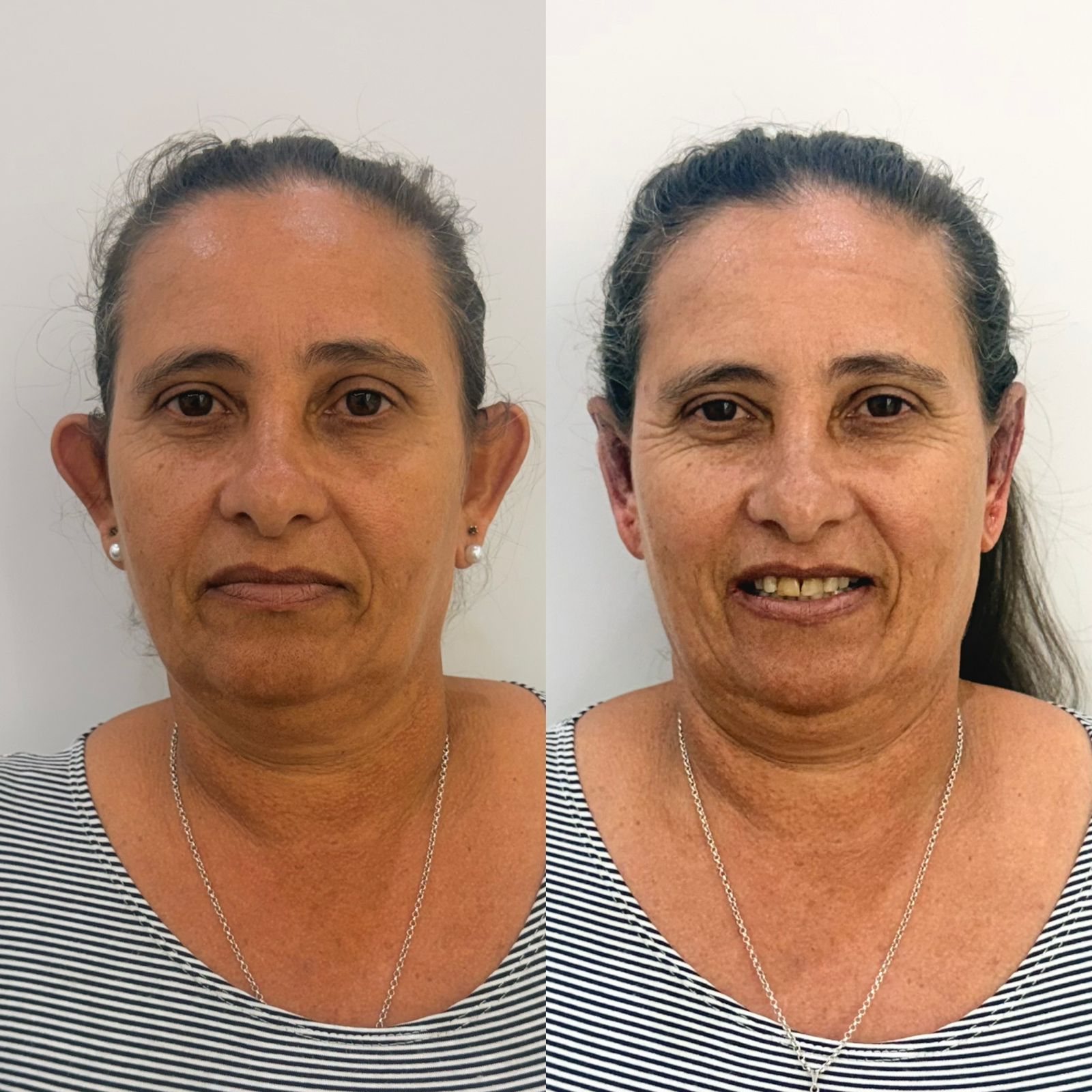 Resultado