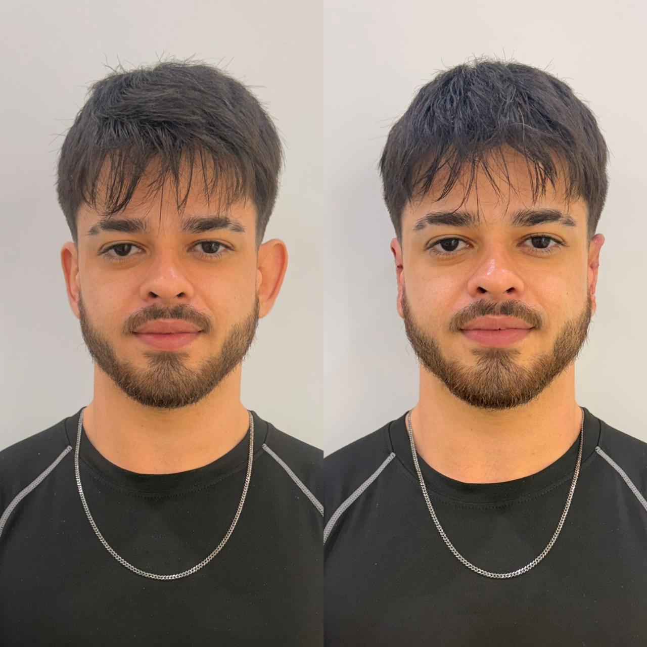 Resultado